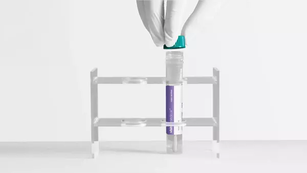 Visby Medical Sexual Health Test Visby Medical Sexual Health Test