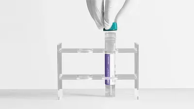 Visby Medical Sexual Health Test Visby Medical Sexual Health Test